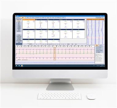 Dünaamiline EKG Holteri analüüsisüsteem
